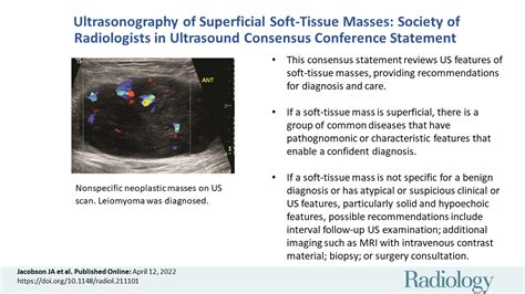 Ultrasonography of Superficial Soft